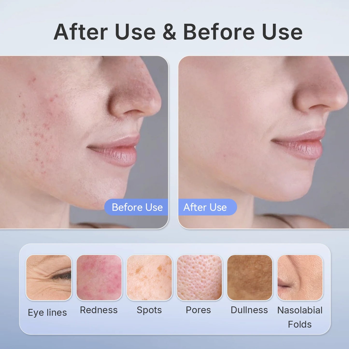 510K Wireless Near-Infrared and Red Light Therapy Facial Mask for Powerful Anti-Ageing Professional Ultra-Light Mask